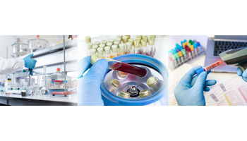Immuntherapie bei Krebsdiagnose – Remission möglich?